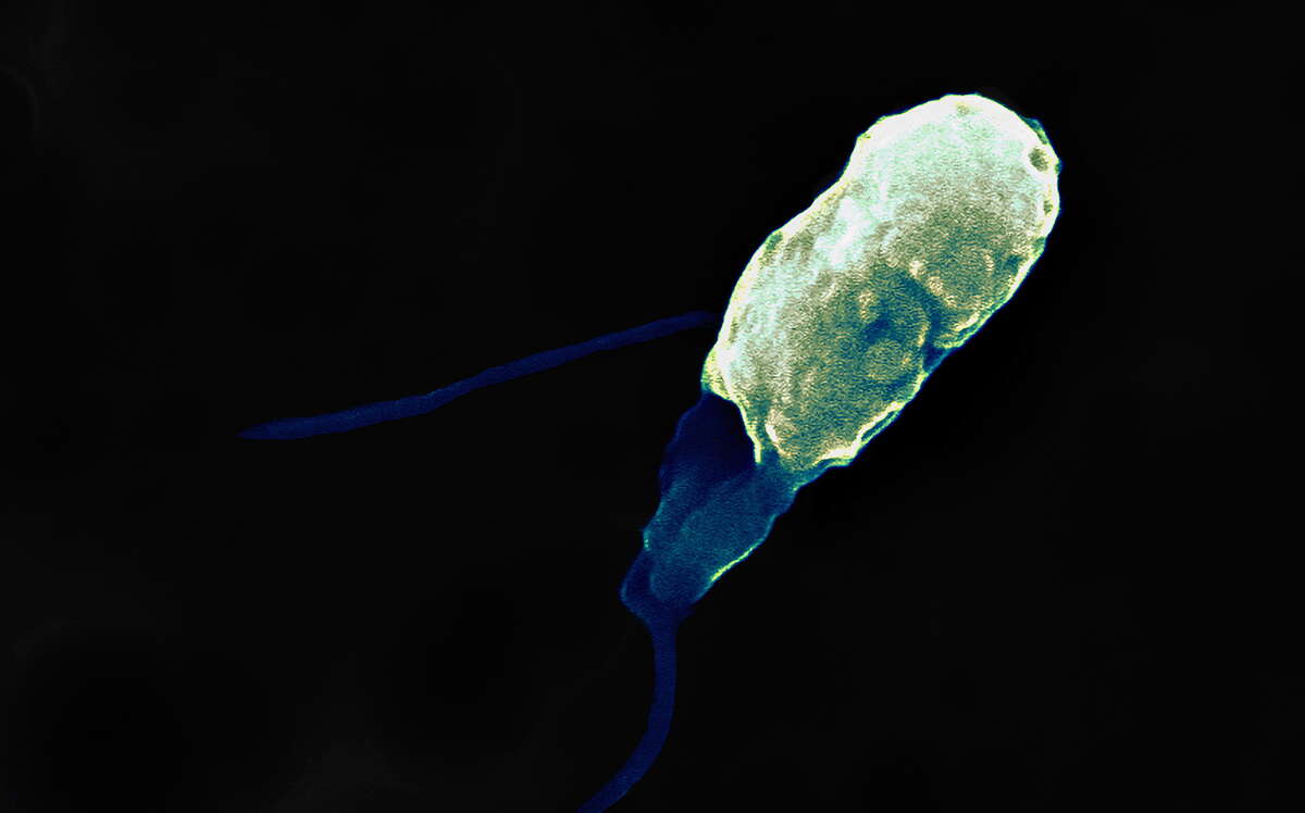 A tiny organism is shown against a dark background.